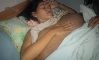Ibu Sumarni Penderita Tumor Berharap Segera Sembuh dan Punya Momongan