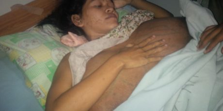 Ibu Sumarni Penderita Tumor Berharap Segera Sembuh dan Punya Momongan